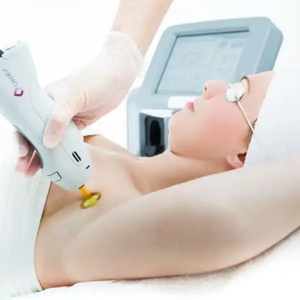 Laser Hair Removal